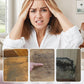 🫧Effective Wood Mold ＆ Mildew Stain Remover
